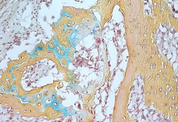 Stanford Researchers Identify Human Bone Stem Cells